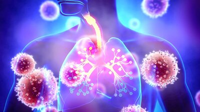 Acute Respiratory Infections