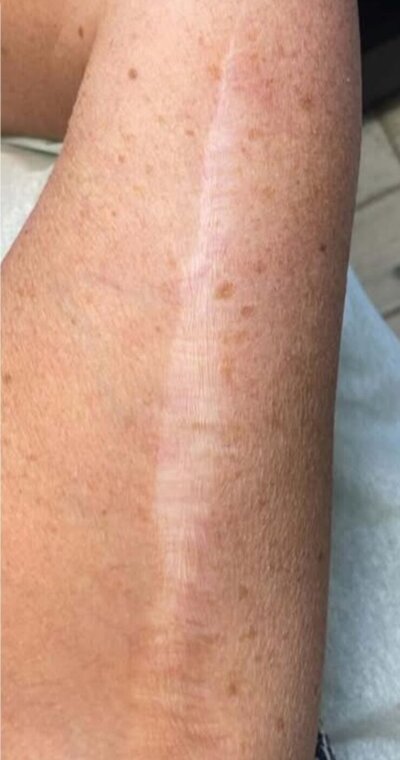 avant après salon esthétique trait delicat Montlucon