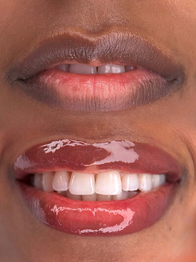 dark lips neutralization in New York