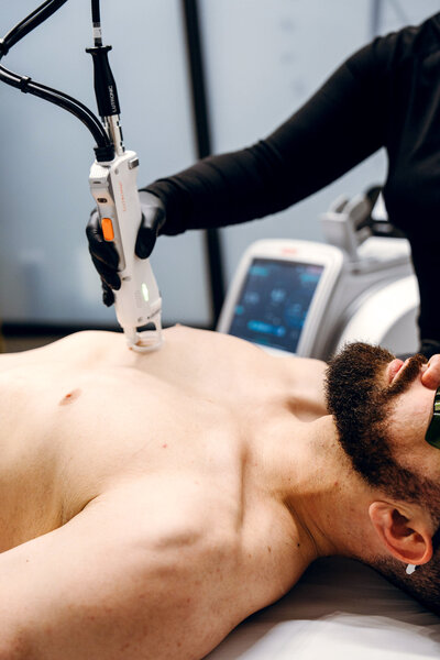 Laser hair removal procedure in progress on male client’s chest using Clarity II device