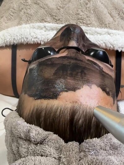carbonpeel