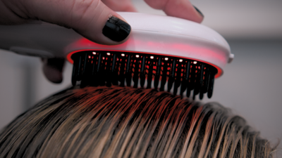 Scalp Analysis and tratment