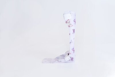 Close-up image of a Polypro ankle-foot orthosis, a supportive device for ankle and foot stabilization