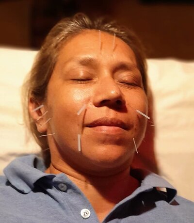 Tranquil healing room at Yellow Tree Florsser in San Miguel De Allende, where EnForma’s featured acupuncturists provide holistic treatments for balance, relaxation, and energy restoration.