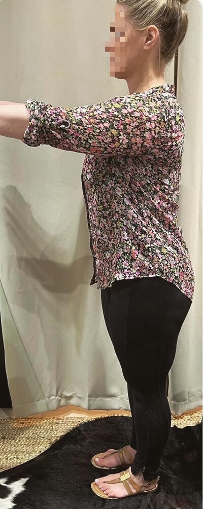 Before Side