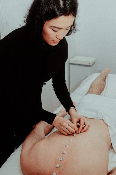 Annie Khaw-Loupis adminsters Moxibustion on male patient's back as he lays facedown on acupuncture table