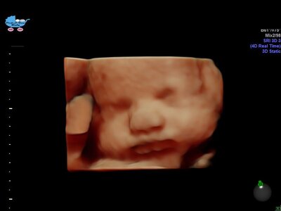 HD Ultrasound Image Gallery