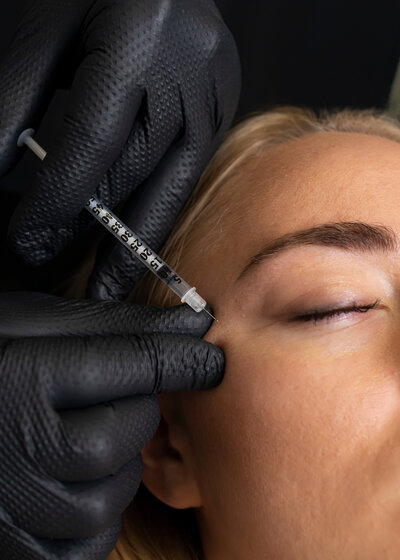 TART-Aesthetics-Botox-injectables