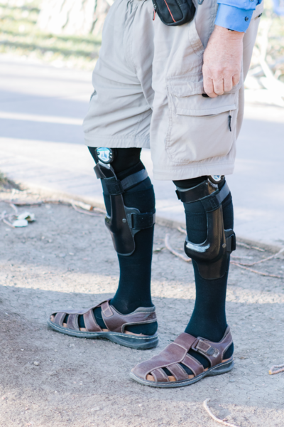 An elderly man standing while wearing a knee brace