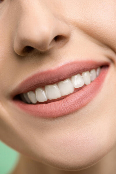 Dentist office near Middleton Idaho. Close up of a clean, white smile.