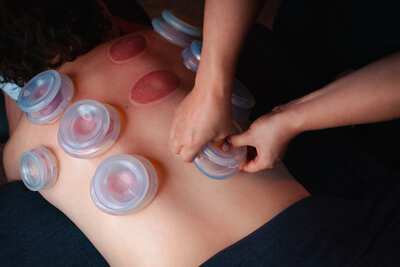 increase your range of motion through cupping therapy