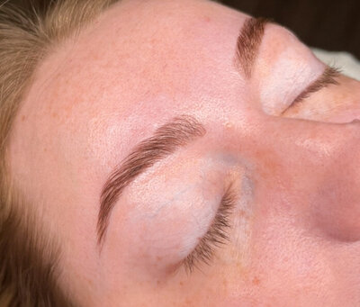 Wrinkle Relaxers in Cowlitz County