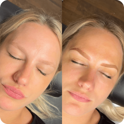 Results before and after of powder eyebrow treatment from Refresh Aesthetics