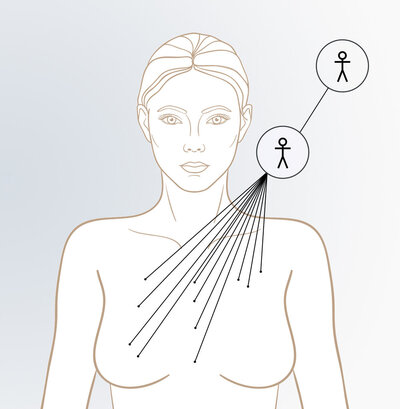 A diagram of a woman's torso, with lines attached to her chest. Their point of origin is a stick figure, representing a curse.