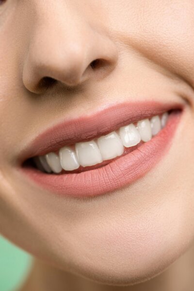 Close up of a smile that is not gummy for gummy smile treatment.