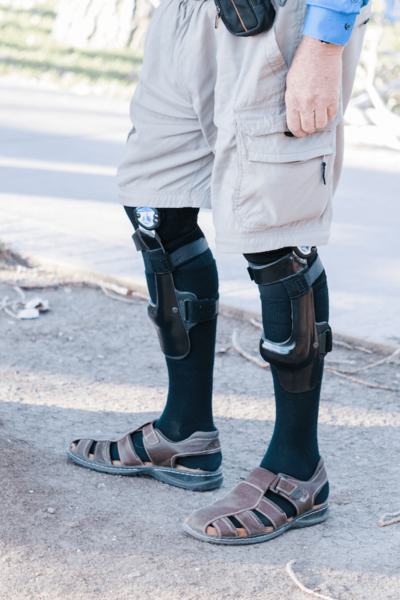 Close-up shot of an elderly person standing while wearing a knee brace, providing support and stability for joint pain, arthritis, or injury recovery