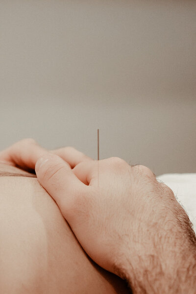 Male patient has acupuncture needle sticking out of hand as he lays atop table.