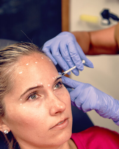 Wrinkle Relaxers in Cowlitz County