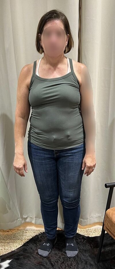 Before Front