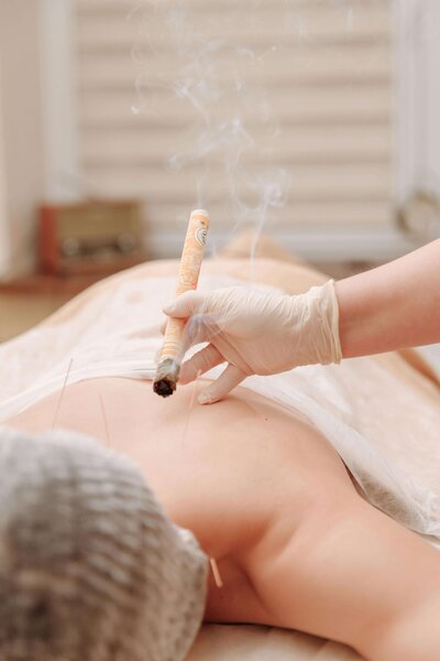 Acupuncture and moxibustion being performed on patient's back