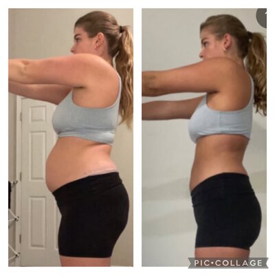 Before and after of Carly