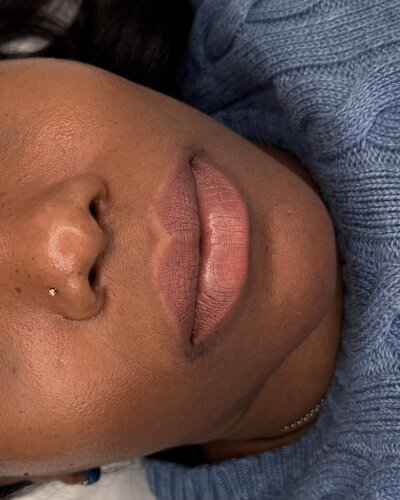 Healed Dark Lip Neutralization 