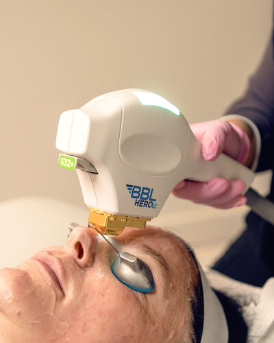 Wrinkle Relaxers in Cowlitz County