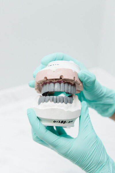 Prosthodontist showing a full set of teeth model to explain full mouth rehabilitation at Peak Prosthodontics in Lethbridge, Alberta.