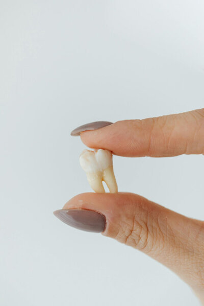 A hand holding wisdom teeth or another tooth that has been extracted.