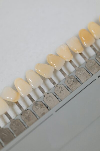 Various shades of tooth models used to demonstrate teeth whitening results at Peak Prosthodontics in Lethbridge, Alberta.