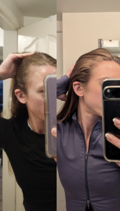 hairtransformation.arbonne