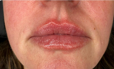 Lips2