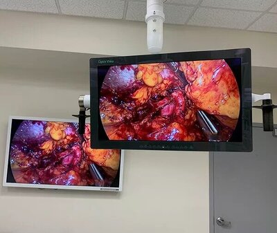Optik-2-screens.jpg