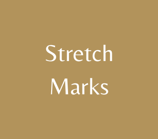 Microneedling Stretch Marks