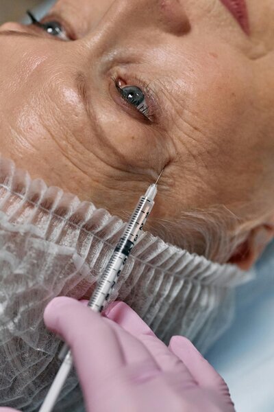 Older women receiving dermal fillers near eyebrow