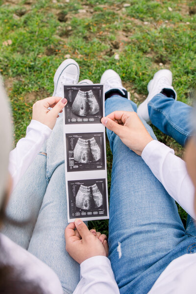 Husband and wife show off their sonogram for their pregnancy announcement in Fresno