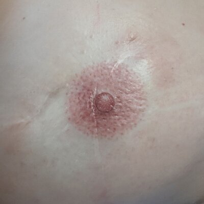 areola_closeup