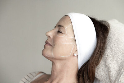 Liquid facelift door Lizenka Adriaanse cosmetisch arts Rotterdam