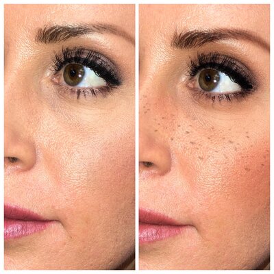 Orange-County-Permanent-Makeup-Beauty-Marks-Freckles