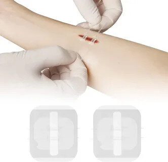 Lacerations (Minor Cuts)