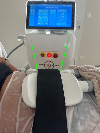 machine cryolipolyse centre esthétique