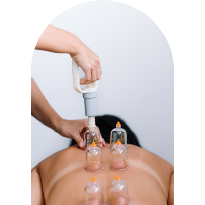 Brand photo of a woman getting cupping on her back