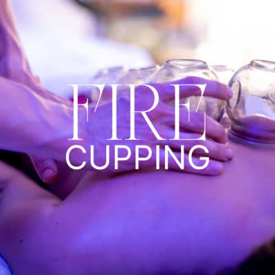 fire cupping near Columbus, OH