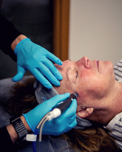 Hydrafacial Treatment in Cowlitz County