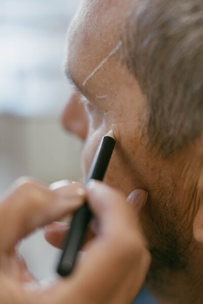 Botox for men treatment in Yakima WA