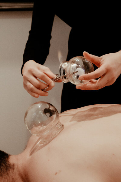 Male patient lays on acupuncture table as practitioner suctions glass cups to his back