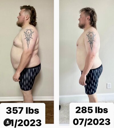 Before and after of Hunter