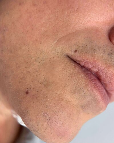 Beauty  mark tattoo in NYC