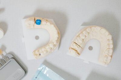 Two sets of teeth models showcasing dental crowns and bridges for patient education at Peak Prosthodontics. Serving Southern Alberta including Medicine Hat and Pincher Creek.