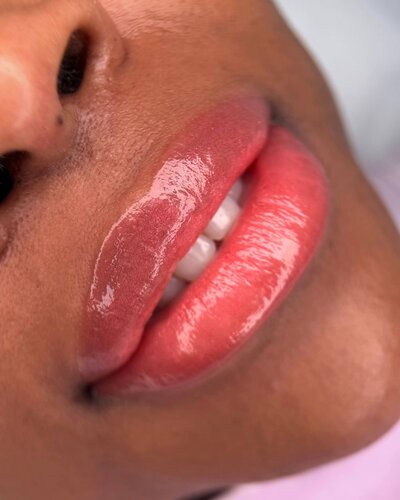 Dark Lip Neutralization